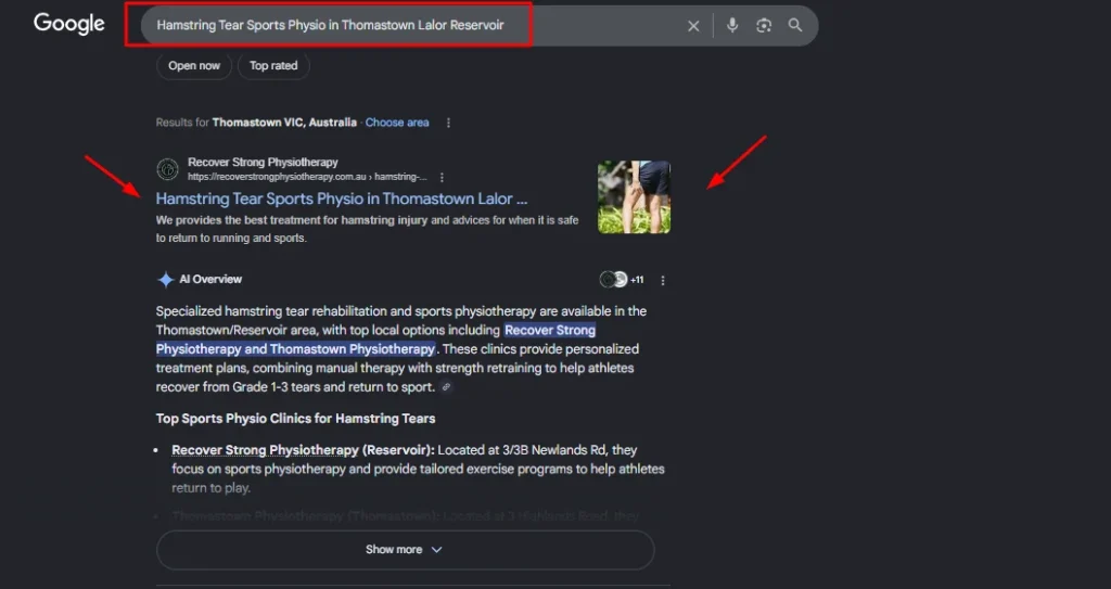 Google search results for Hamstring Tear Sports Physio in Thomastown Lalor Reservoir featuring Recover Strong Physiotherapy and an AI Overview for injury rehabilitation.
